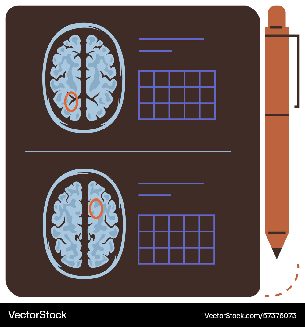 Brain scans with highlighted areas and data charts Brain scans with highlighted areas and data charts vector image