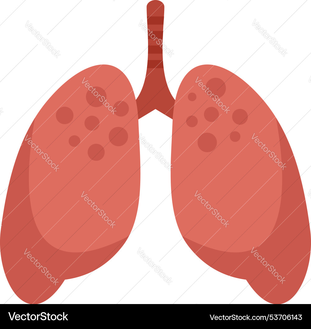 This Shows Lungs With Pneumonia Royalty Free Vector Image
