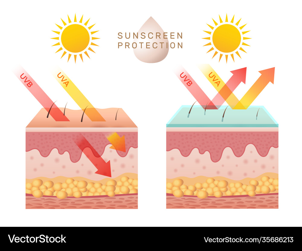 Uv skin protection damaged human peels vector image