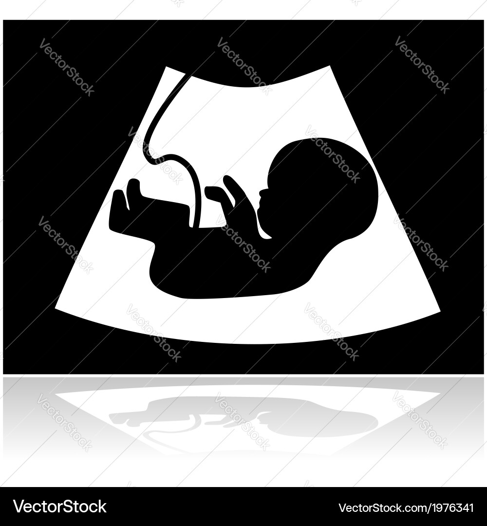 Ultrasound Scan of Baby in Womb Vector Image