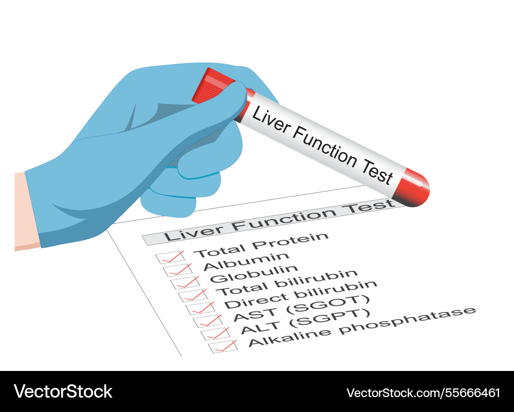 Liver function tests are blood – Royalty-Free Vector | VectorStock