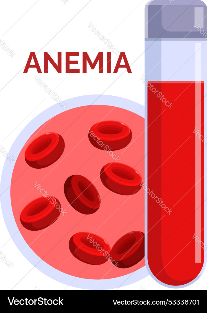 Blood test showing anemia with low red cell Vector Image