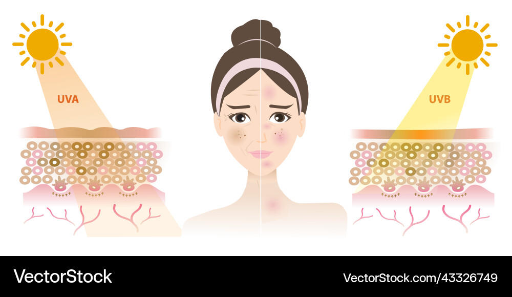 Comparison of damaged skin face from uva and uvb Comparison of damaged skin face from uva and uvb vector image