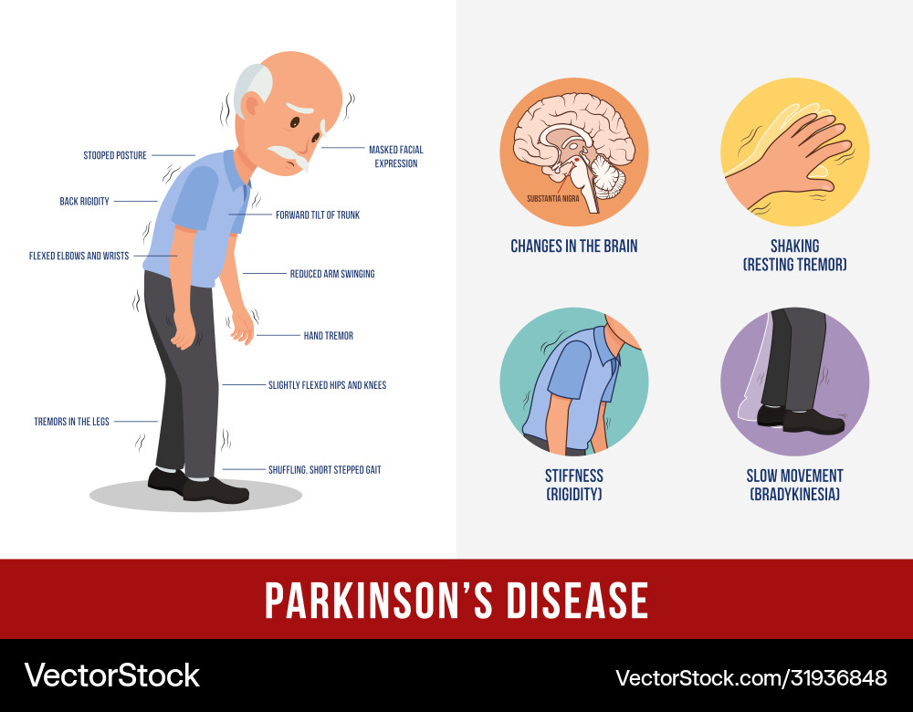 Parkinsons disease Parkinsons disease vector image