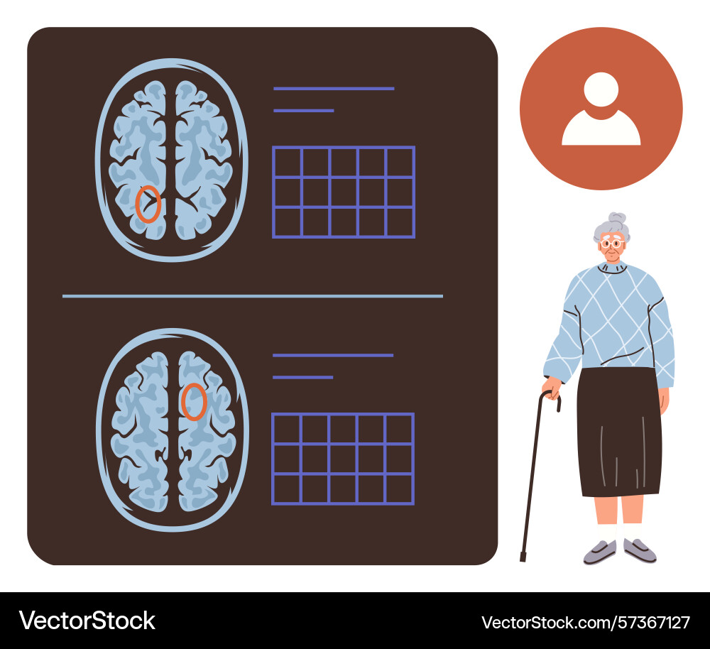 Brain scan results highlighting abnormality Brain scan results highlighting abnormality vector image