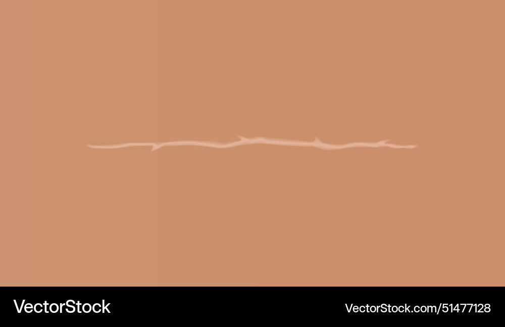 Healing wounds skin scar stitched gash and cut Healing wounds skin scar stitched gash and cut vector image