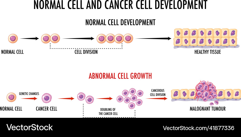 https://cdn.vectorstock.com/i/1000v/73/36/normal-vs-cancer-cells-diagram-vector-41877336.jpg