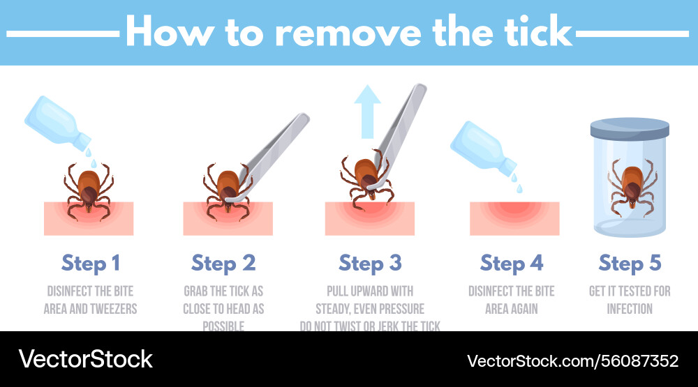 Tick Removal How To Remove Ticks Insect Royalty Free Vector Tick Removal How To Remove Ticks Insect Vector 56087352 