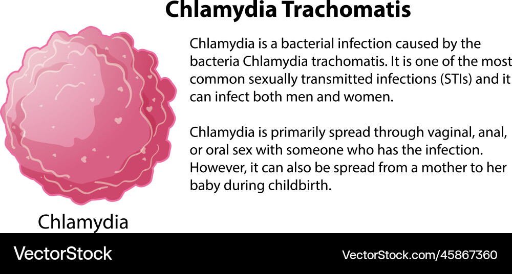 Chlamydia trachomatis with explanation Chlamydia trachomatis with explanation vector image