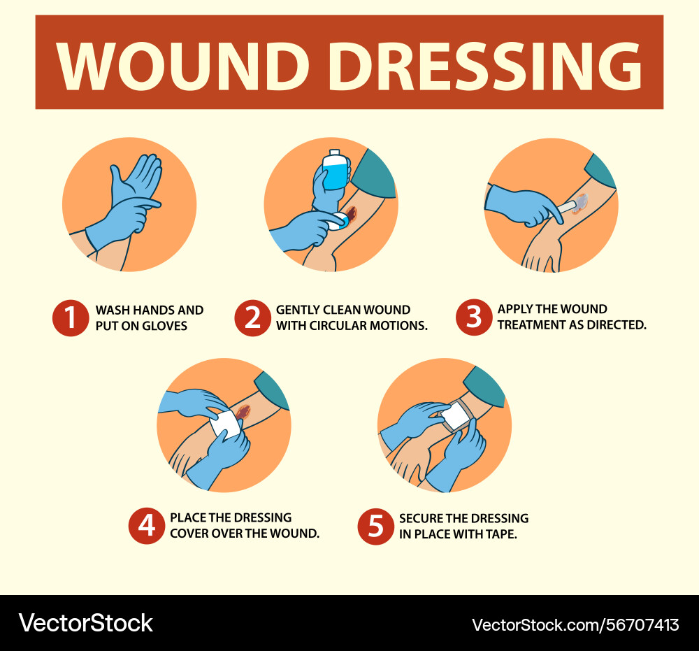 Wound Dressing Procedure Guide Royalty-Free Vector | VectorStock Wound Dressing Procedure Guide Royalty-Free Vector | VectorStock