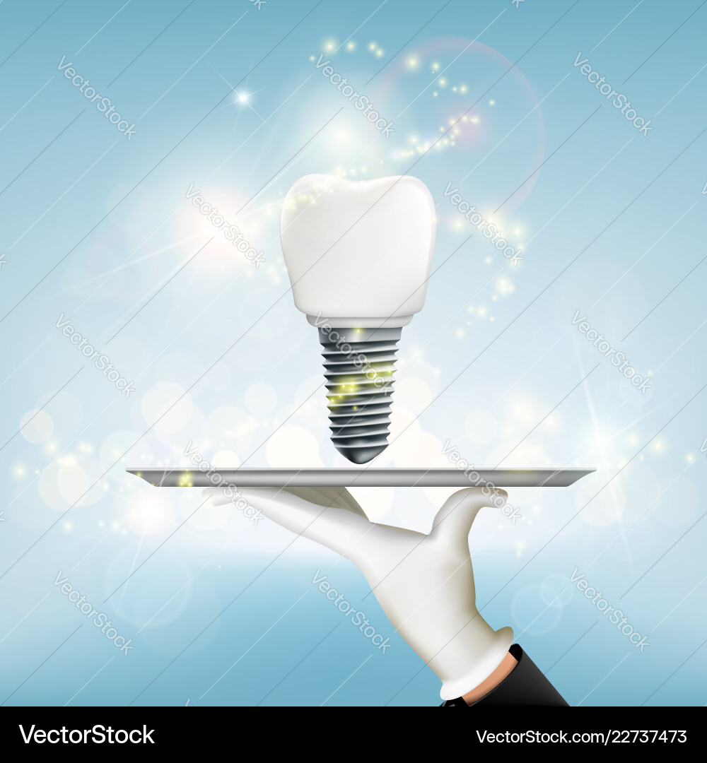 Dentist holding a dental implant on tray Dentist holding a dental implant on tray vector image