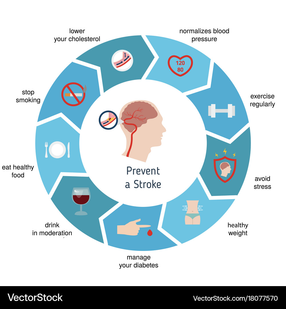 Stroke Prevention Infographics Royalty Free Vector Image