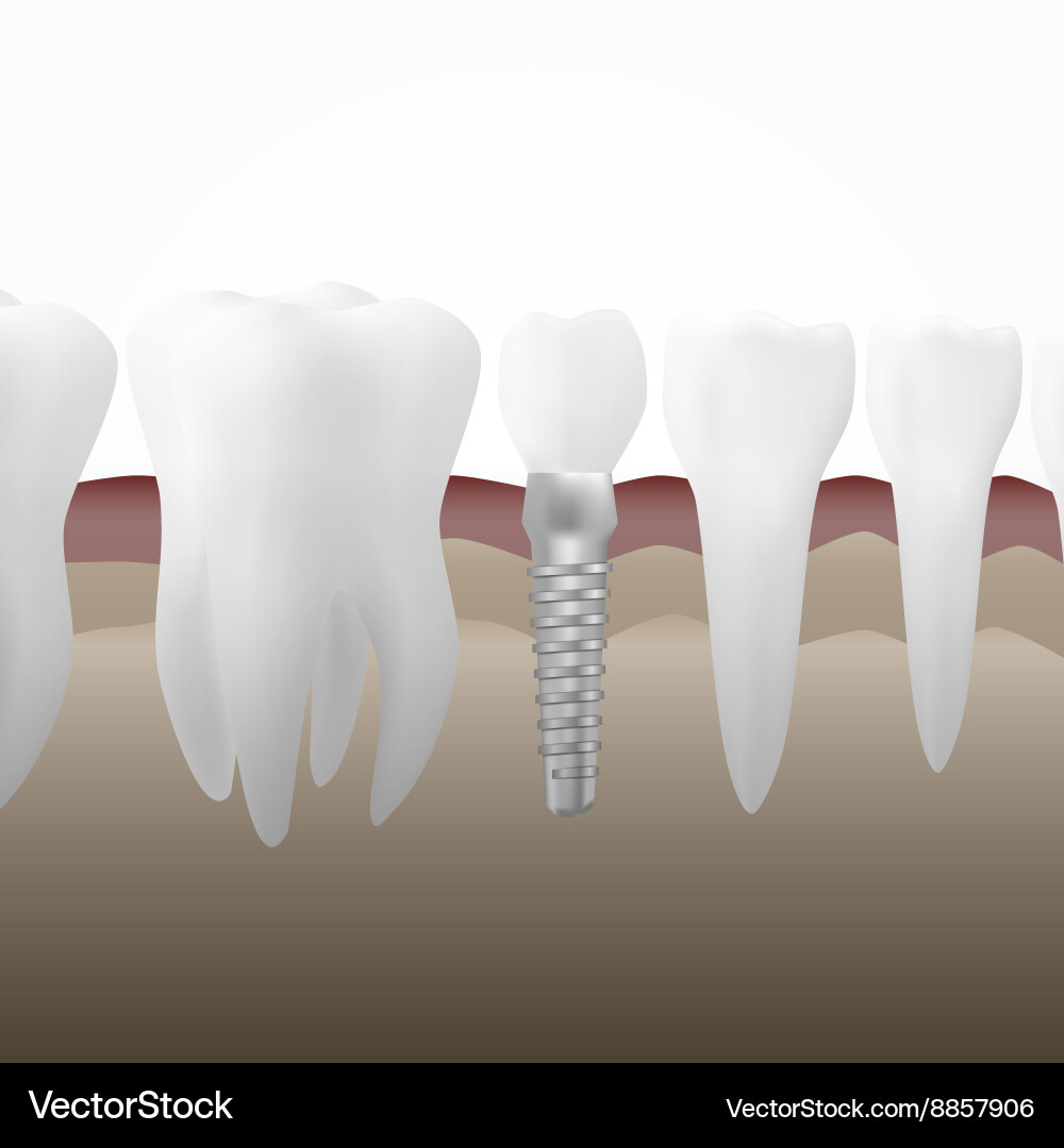 Set of tree tooth vector image