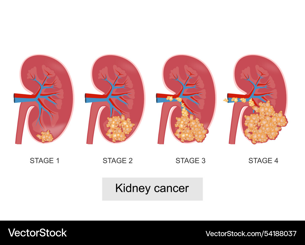 Staging is the process of finding out how far Staging is the process of finding out how far vector image