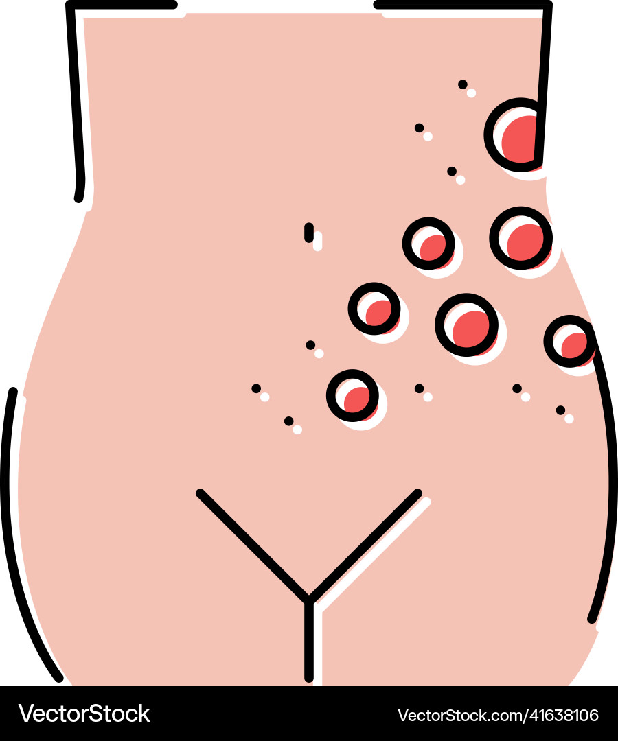 Lichen shingles disease color icon Lichen shingles disease color icon vector image