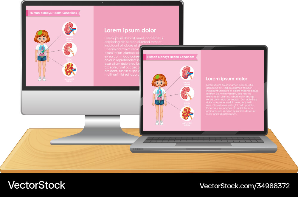 Computer with science infographic on screen Computer with science infographic on screen vector image