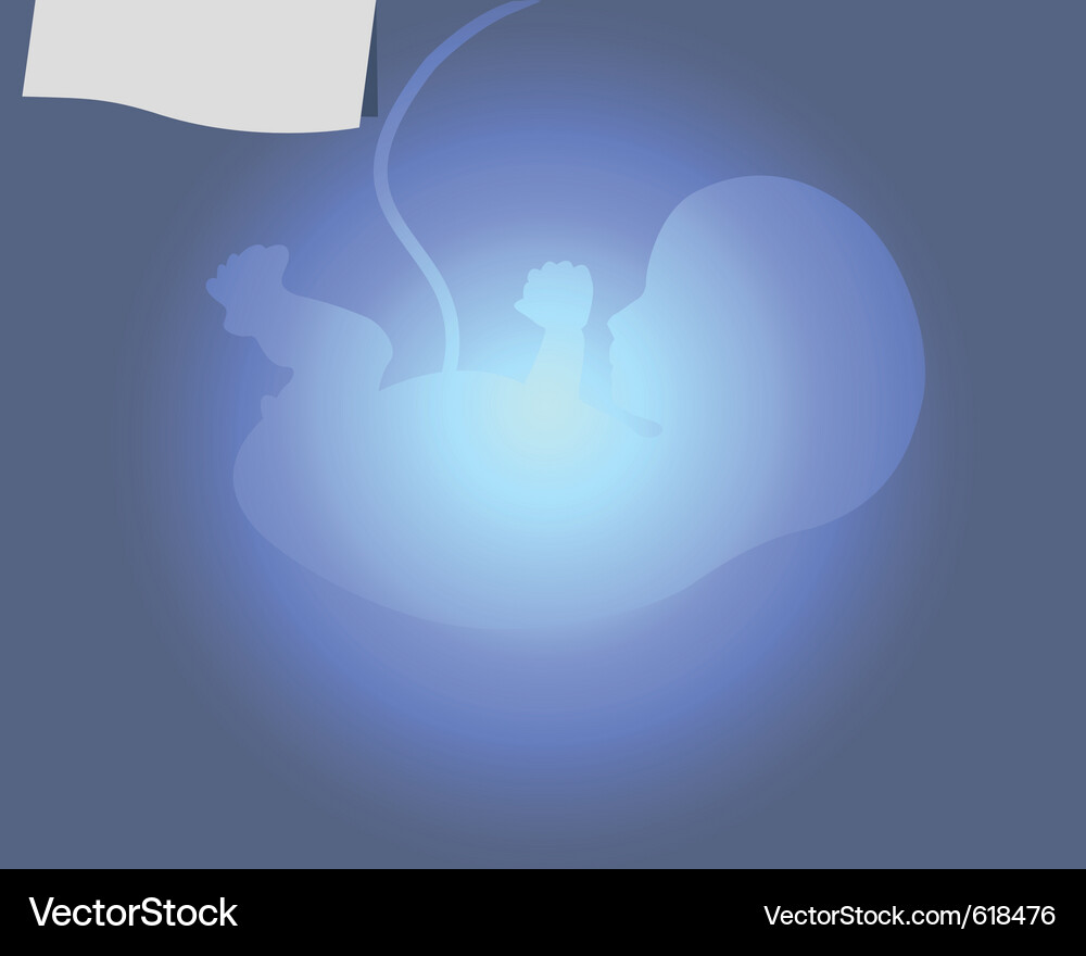 Ultrasound Scan of Fetus Vector Image