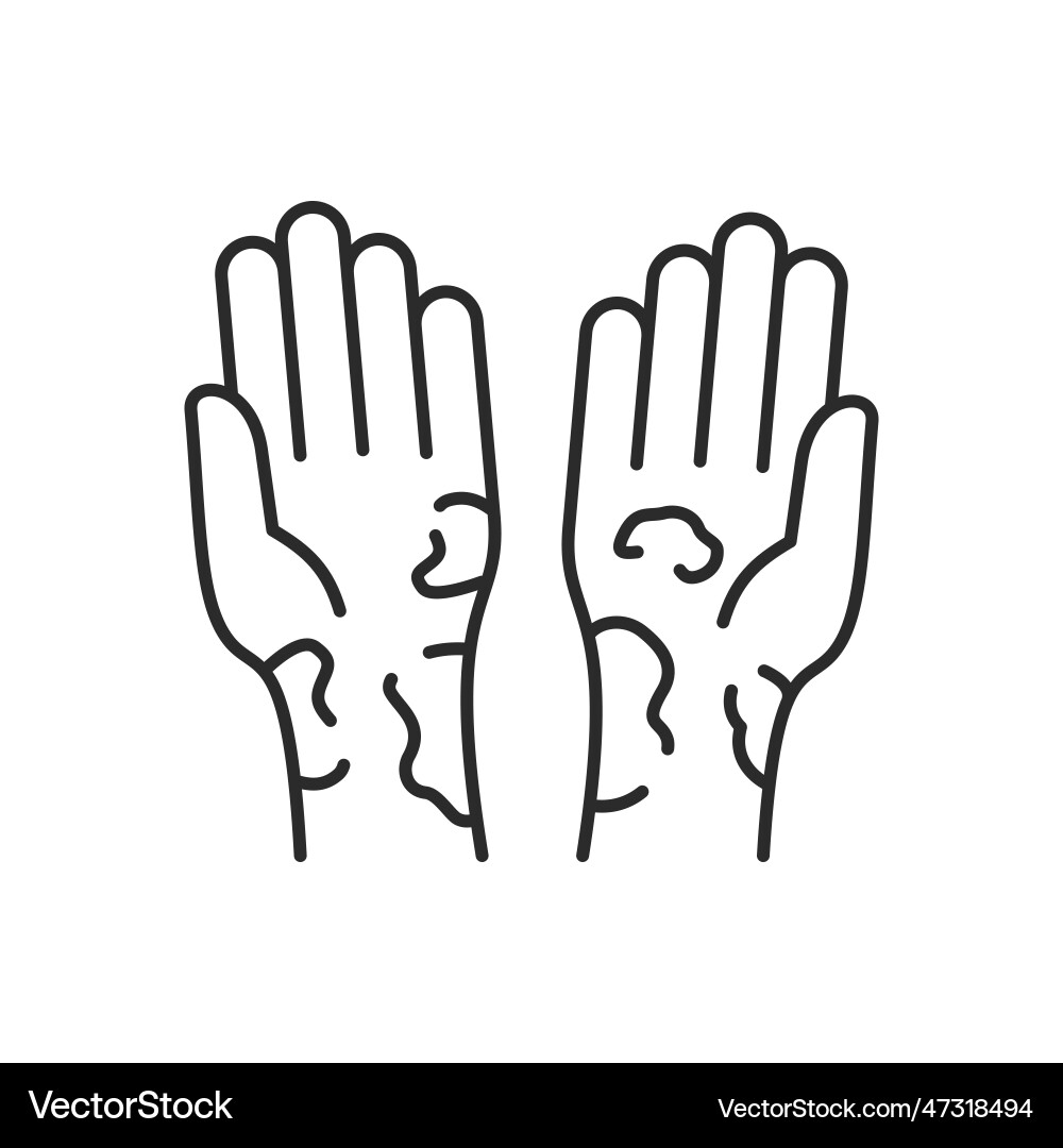 Allergy symptoms icon Allergy symptoms icon vector image