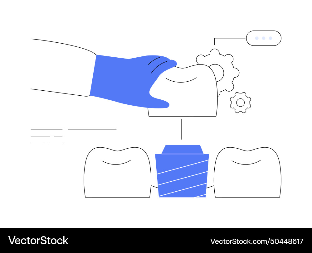 Artificial tooth placement abstract concept Artificial tooth placement abstract concept Vector Image
