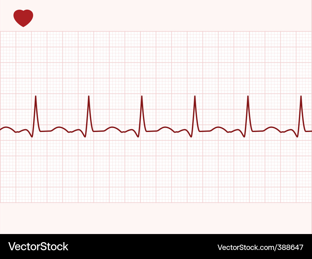 Elektronisches Cardiogramm Display Vektorbild