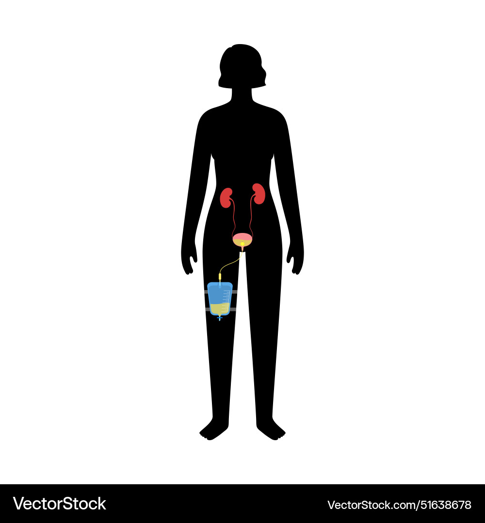 Urinary drainage bag Royalty Free Vector Image