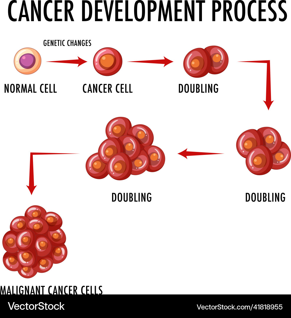 Cancer development process infographic vector image