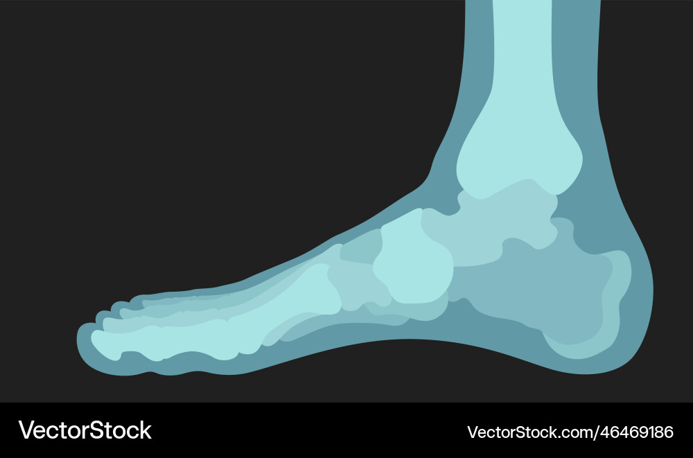 Leg 3d x ray shot human anatomy bone medical vector image