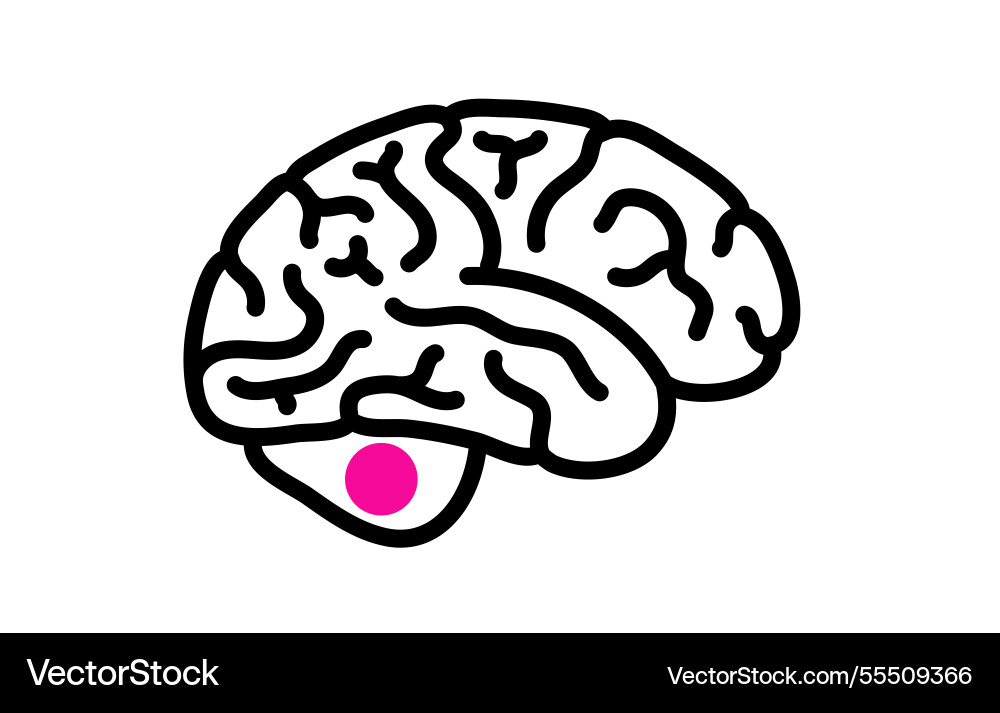 Cerebellum brain cancer Cerebellum brain cancer vector image