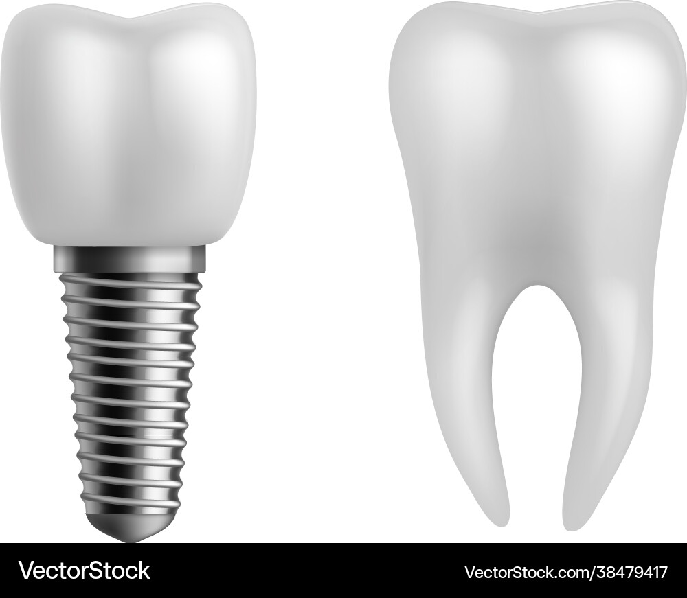Dental implant and teeth realistic orthodontic Dental implant and teeth realistic orthodontic vector image