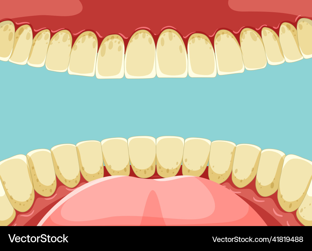 Human teeth inside mouth with yellow Human teeth inside mouth with yellow vector image
