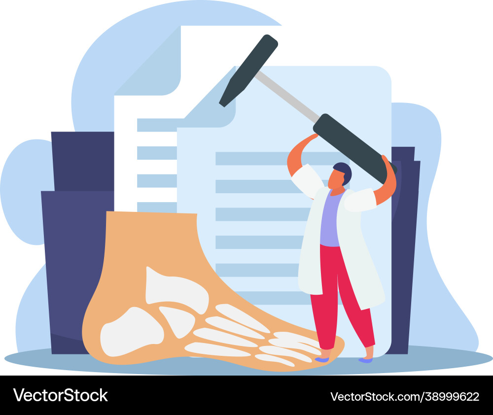 Foot doctor hammer composition vector image