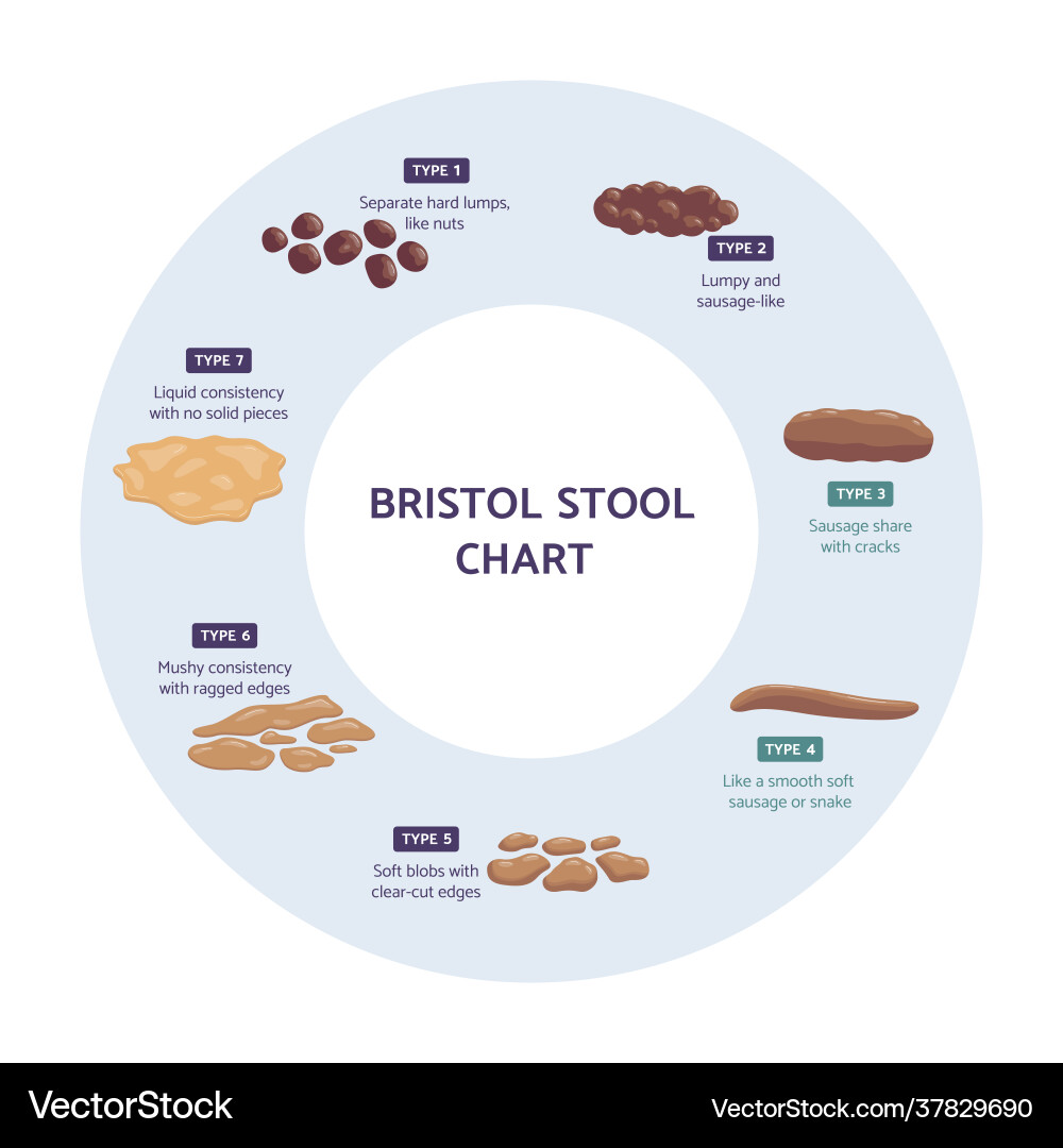 bristol-stool-chart-faeces-types-royalty-free-vector-image for Bristol Stool Chart Free Printable Bristol Stool Chart - Faeces Types Royalty Free Vector Image for Bristol Stool Chart Free Printable