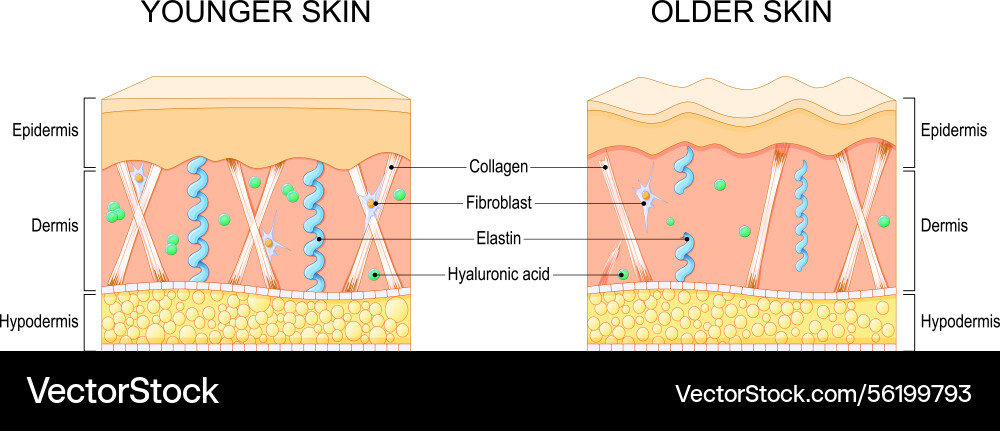 Aging skin chages wrinkle formation Royalty Free Vector