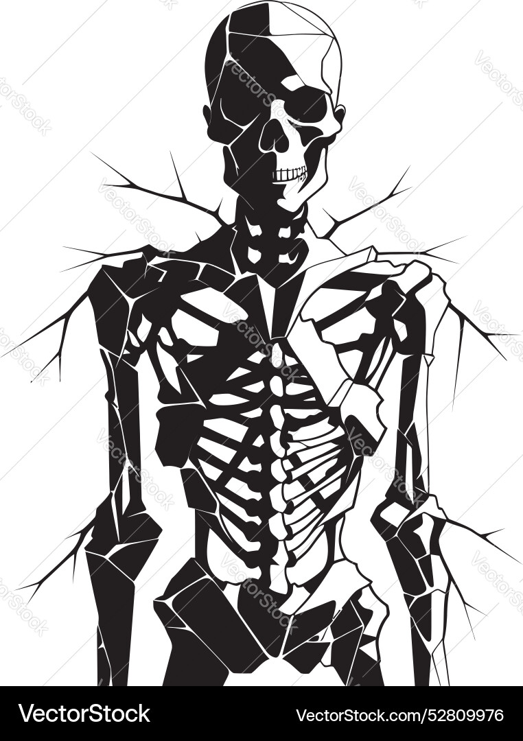 Fracture fusion fractured skeleton symbol design Vector Image