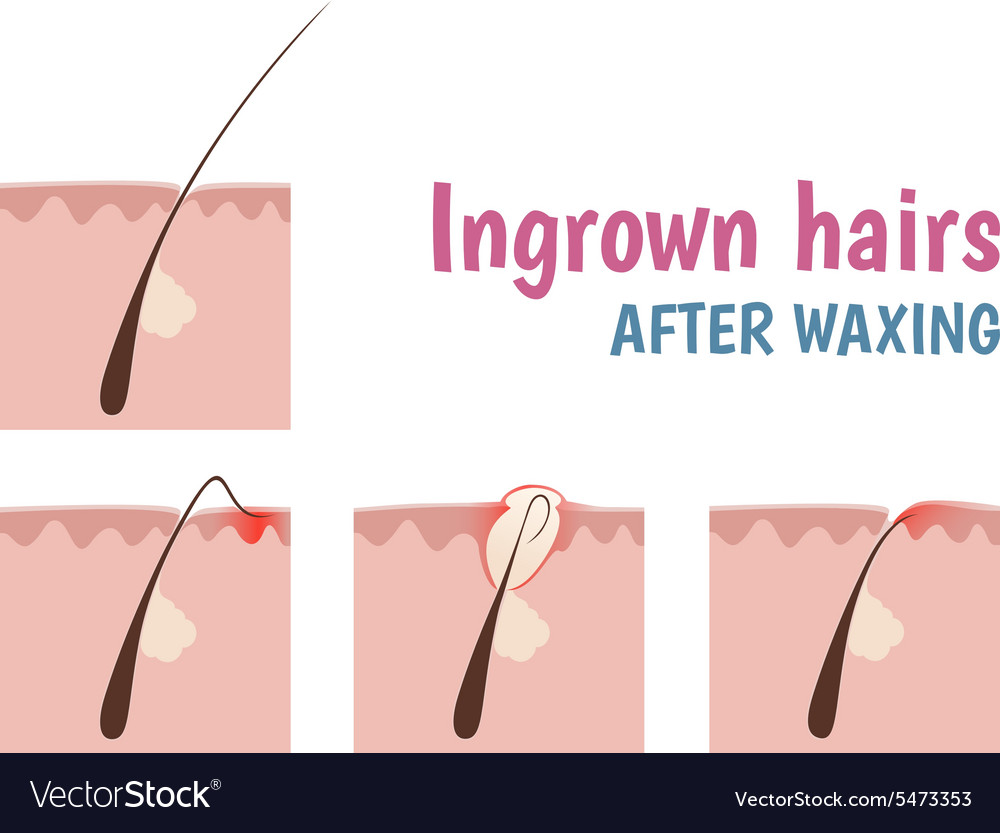 Structure Of The Hair Follicle Royalty Free Vector Image