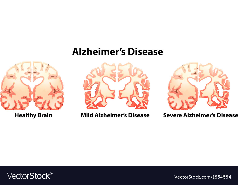 Free Free Alzheimer&#039;s Elephant Svg 375 SVG PNG EPS DXF File