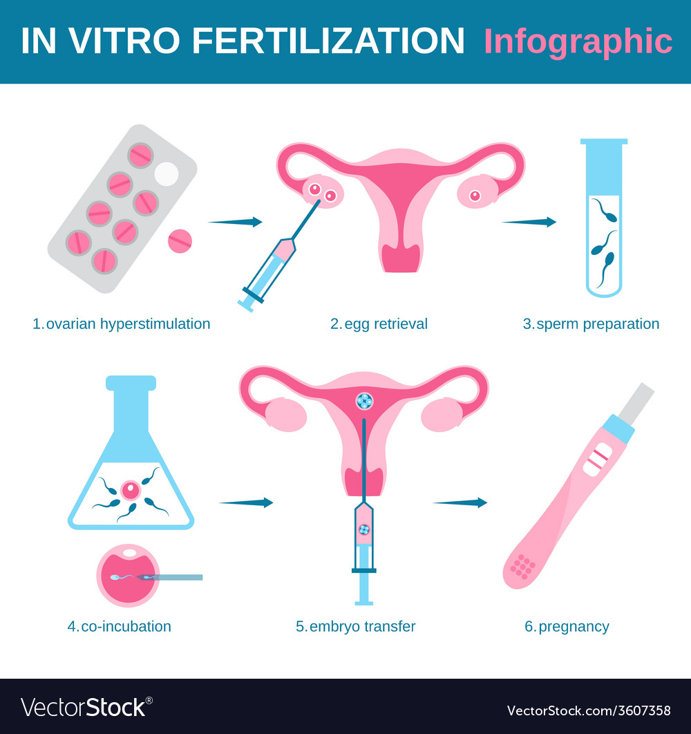 the technique of invitro fertilization with embryo transfer Other articles where embryo transfer is discussed:commercial in vitro fertilization and embryo-transfer techniques for the production of livestock, particularly cattle and sheep. the technique of invitro fertilization with embryo transfer Other articles where embryo transfer is discussed:commercial in vitro fertilization and embryo-transfer techniques for the production of livestock, particularly cattle and sheep.