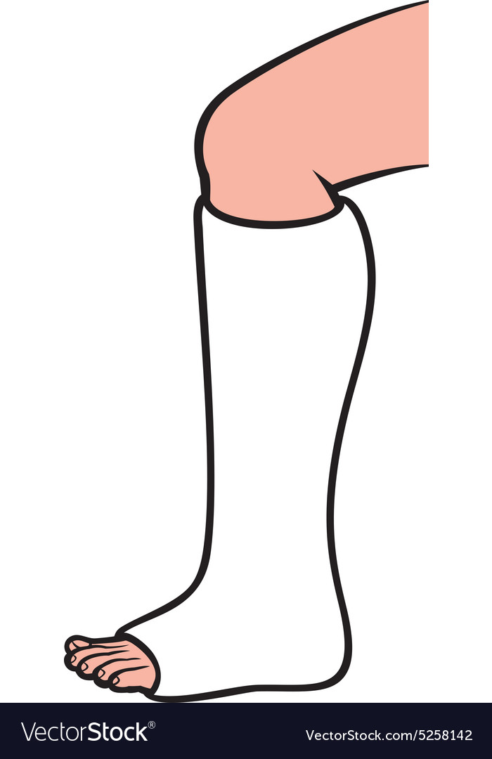Short Leg Cast Royalty Free Vector Image Vectorstock Short Leg Cast Royalty Free Vector Image Vectorstock