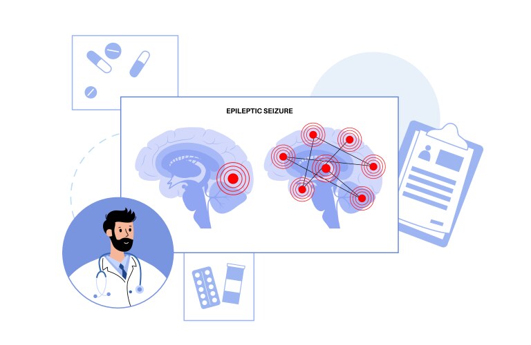 Epilepsy seizure concept Royalty Free Vector Image