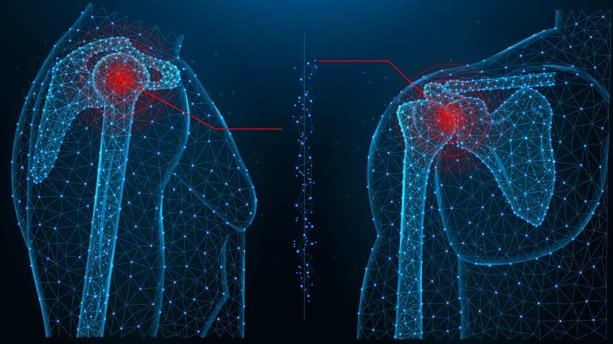 Shoulder joint pain blue polygonal Vector Image