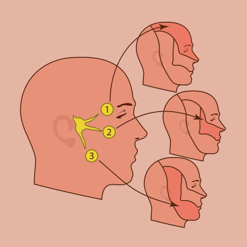 Trigeminal neuralgia cranial nerve Royalty Free Vector Image