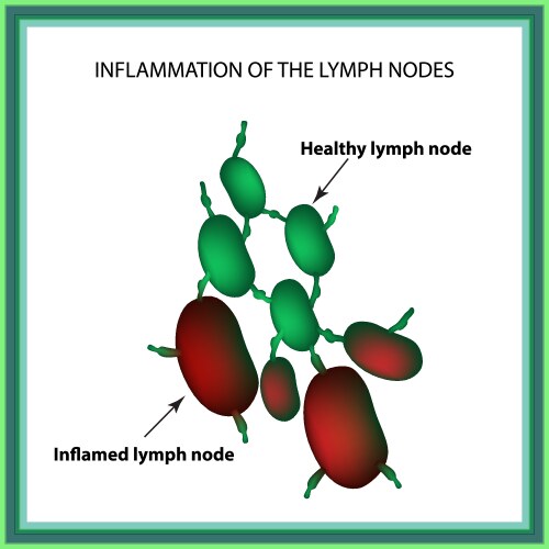 Lymph Node Anatomy Royalty Free Vector Image - VectorStock