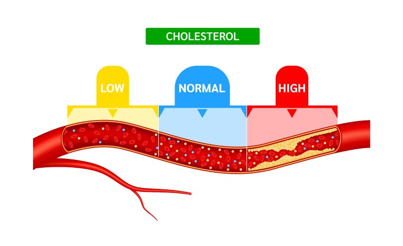 Normal blood flow and cholesterol artery Vector Image