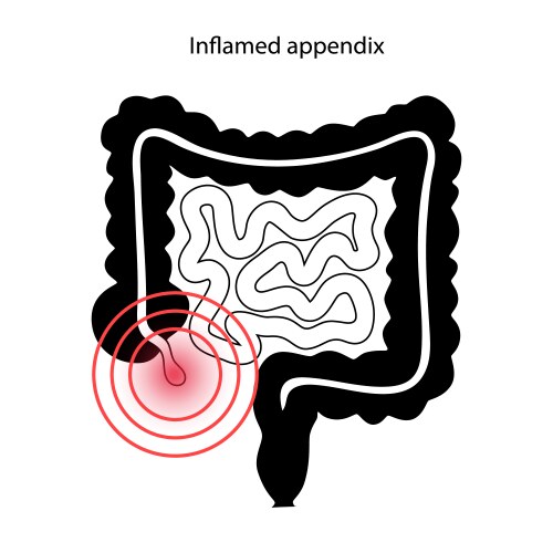 Appendix Vector Images & Graphics for Commercial Use | VectorStock