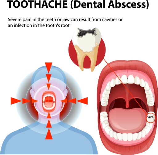 Toothache causes and symptoms Royalty Free Vector Image