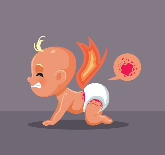 little baby having a diaper rash burning red skin vector image