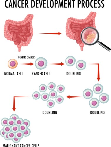 Diagram showing normal and cancer cells in human vector image