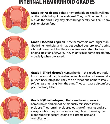 Types of joints educational medical infographic Vector Image