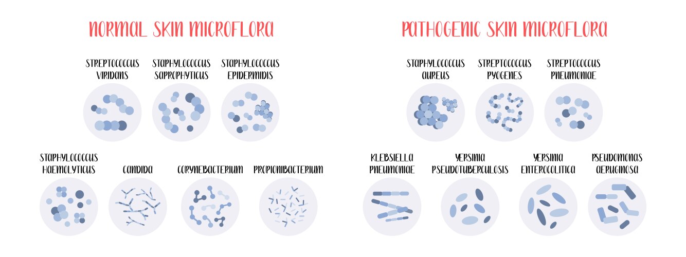 Microflora Examples Intestinal microflora normal and pathogenic Vector Image