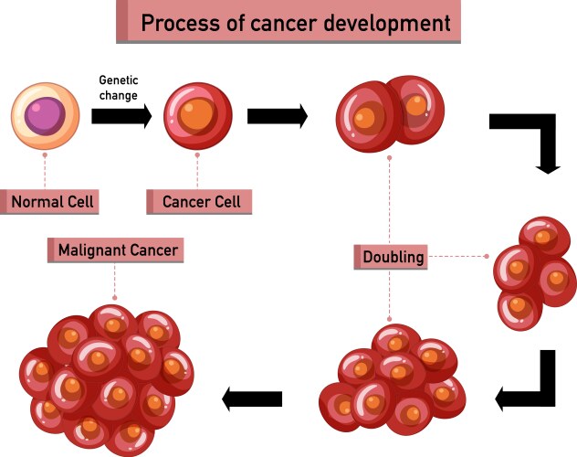 process of cancer development infographic vector image